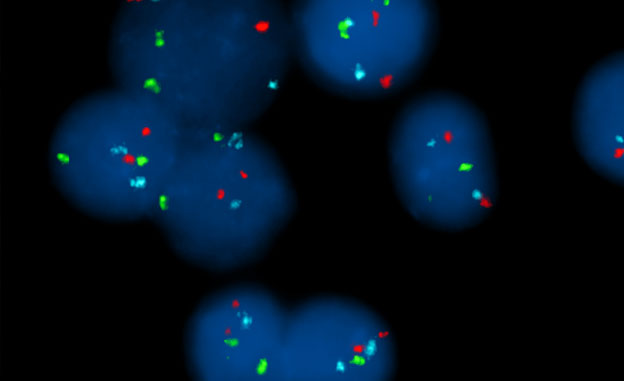 FISH-Hybridation-In-Situ-Fluorescente
